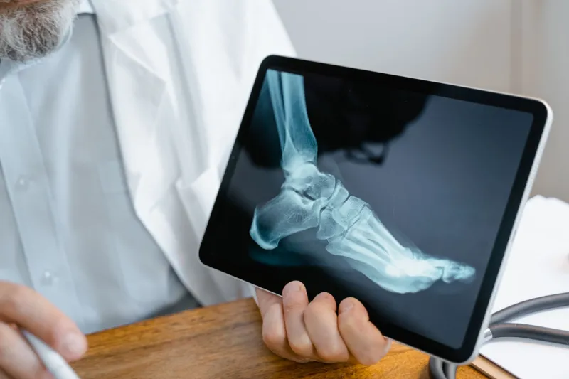 Six Weeks in a Cast Was Getting Off Easy: The Brutal Reality of Broken Bones Before Modern Orthopedics